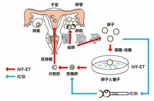 借卵生子有孕妈的遗传基因_遗传基因：借卵生子有孕妈”